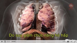 Bệnh phổi tắc nghẽn mạn tính