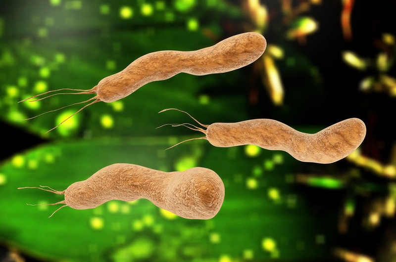 H1 Vi khuẩn Helicobacter Pylori ( Hp)