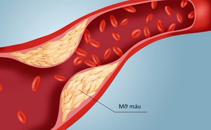 mo mau cao minhanh